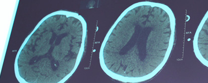 Unidad de Neuroinmunología