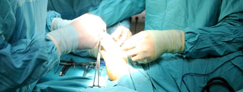 Resultado de imagen para operacion cirugia